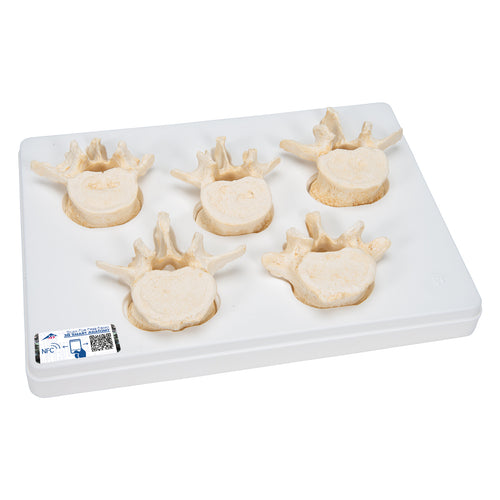 Set de 5 vertebre lombare BONElike™ - 3B Smart Anatomy
