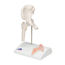 Load image into Gallery viewer, Mini model de arţiculaţie a şoldului uman cu secţiune transversală -3B Smart Anatomy