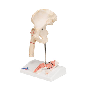 Model de fractură femurală umană şi osteoartrita de şold - 3B Smart Anatomy