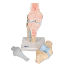 Load image into Gallery viewer, Model secțional de articulație a genunchiului uman, în 3 părți - 3B Smart Anatomy