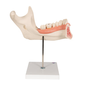Model de maxilare umană de jumătate inferioară, de 3 ori dimensiune completă, în 6 părţi - 3B Smart Anatomy