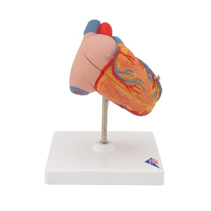 Model clasic de inimă umană cu hipertrofie ventriculară stângă (LVH), 2 părţi - 3B Smart Anatomy