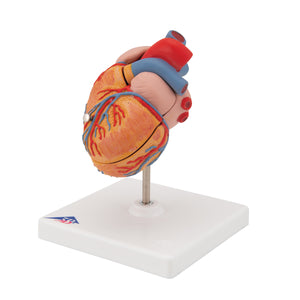 Model clasic de inimă umană cu hipertrofie ventriculară stângă (LVH), 2 părţi - 3B Smart Anatomy