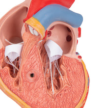 Load image into Gallery viewer, Model clasic de inimă umană cu hipertrofie ventriculară stângă (LVH), 2 părţi - 3B Smart Anatomy
