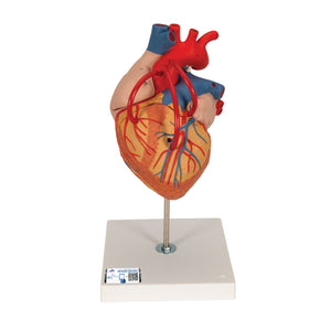Model de inimă umană cu bypass, de 2 ori mărimea naturală, în 4 părţi - 3B Smart Anatomy