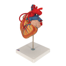 Load image into Gallery viewer, Model de inimă umană cu bypass, de 2 ori mărimea naturală, în 4 părţi - 3B Smart Anatomy