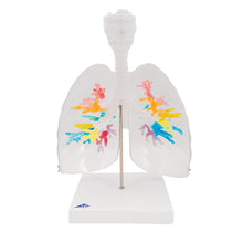Load image into Gallery viewer, Model de arbore bronşic CT cu laringe şi plămâni  - 3B Smart Anatomy