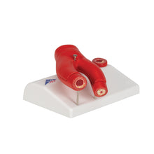 Load image into Gallery viewer, Model de arterioscleroză, cu secţiune transversală a arterei, 2 părţi - 3B Smart Anatomy