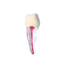 Load image into Gallery viewer, Premolar inferior - endobloc morfologic transparent