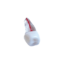 Load image into Gallery viewer, Premolar inferior - endobloc morfologic transparent