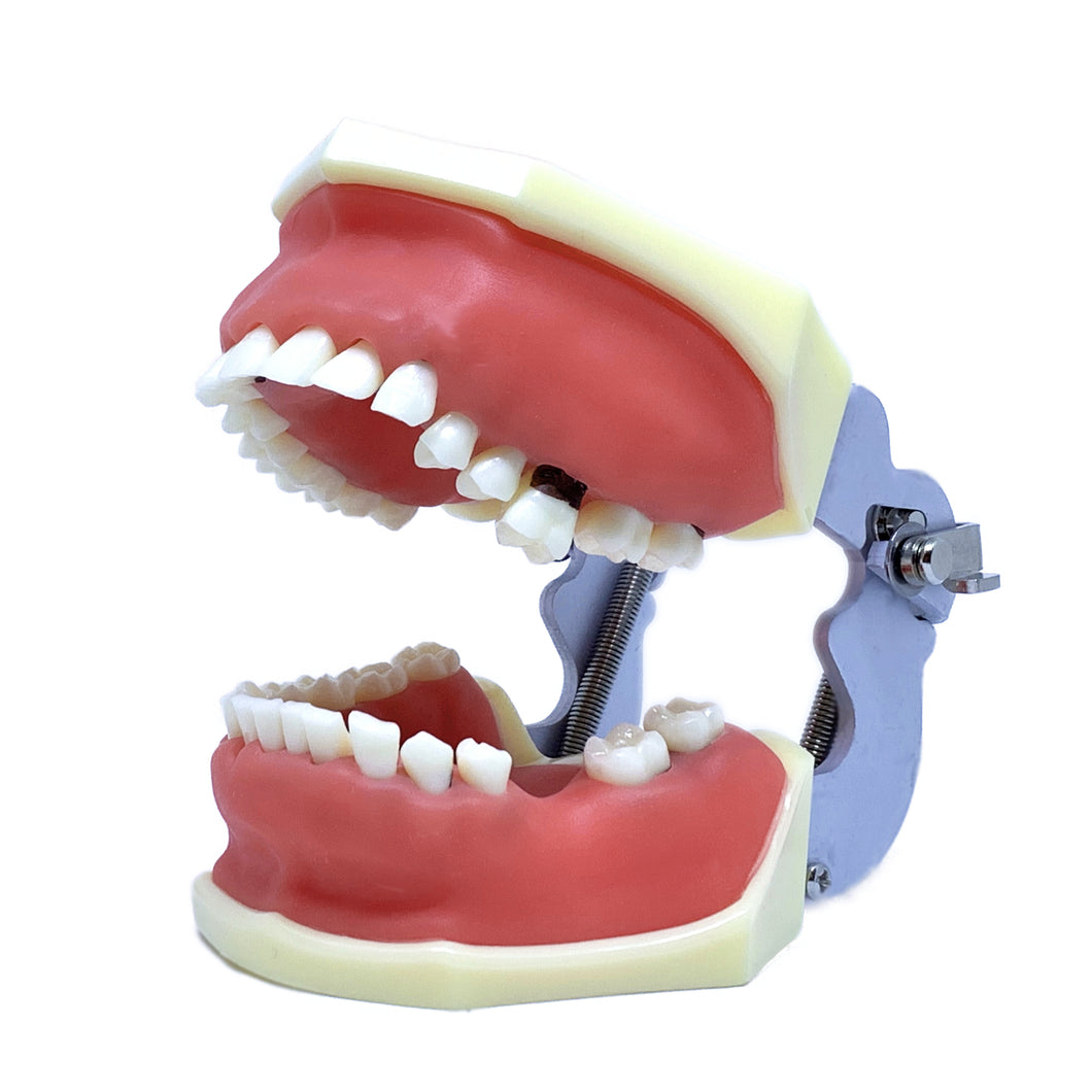 Model boală parodontală cu dinţi detaşabili cu şurub - 4027