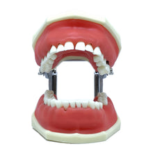 Load image into Gallery viewer, Model boală parodontală cu dinţi detaşabili cu şurub - 4027