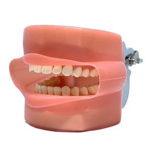 Model cu dinţi detaşabili cu şurub şi gingie fixă moale acoperit de material siliconic 8011