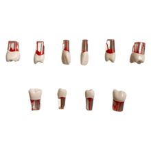 Load image into Gallery viewer, Endobloc 46 -  compatibil cu modelul cu dinţi detaşabili cu şurub 8011