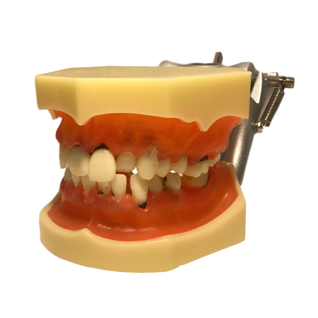 Model boală parodontală fără dinţi detaşabili - 4003