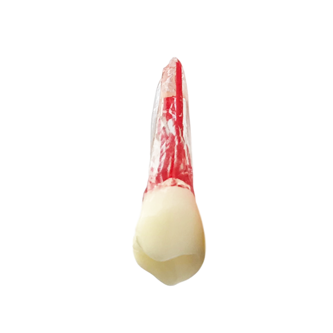 Premolar superior - endobloc morfologic transparent