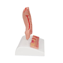 Load image into Gallery viewer, Model de secţiune de stomac uman cu ulcere - 3B Smart Anatomy
