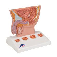 Load image into Gallery viewer, Model de prostată, 1/2 mărime naturală - 3B Smart Anatomy