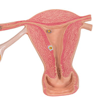 Load image into Gallery viewer, Model de ovare și trompe uterine cu etape de fertilizare, mărit de 2 ori - 3B Smart Anatomy