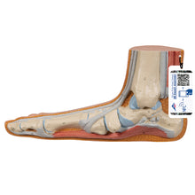 Load image into Gallery viewer, Model de picior plat (Pes Planus) - 3B Smart Anatomy