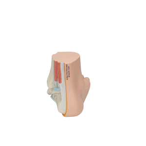 Model de picior plat (Pes Planus) - 3B Smart Anatomy