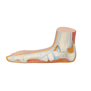 Model de picior plat (Pes Planus) - 3B Smart Anatomy
