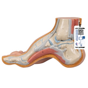 Model de picior gol (Pes Cavus) - 3B Smart Anatomy