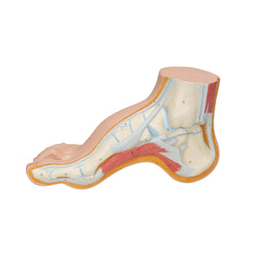 Model de picior gol (Pes Cavus) - 3B Smart Anatomy