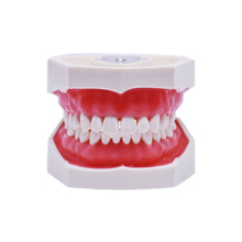 Load image into Gallery viewer, Model cu dinţi detaşabili cu şurub şi gingie fixă moale 8011