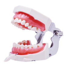 Load image into Gallery viewer, Model cu dinţi detaşabili cu şurub şi gingie fixă moale 8011
