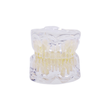 Load image into Gallery viewer, Model transparent dentiţie copii