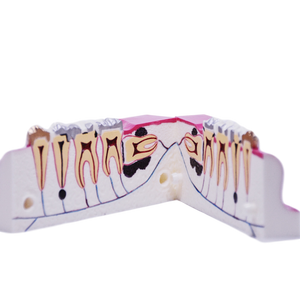 Model secţiune mandibulară zona laterală