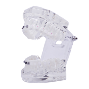 Model ortodontic transparent cu brackeţi metalici şi din ceramică