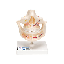 Load image into Gallery viewer, Model de proteză pentru adulţi cu nervi şi rădăcini - 3B Smart Anatomy