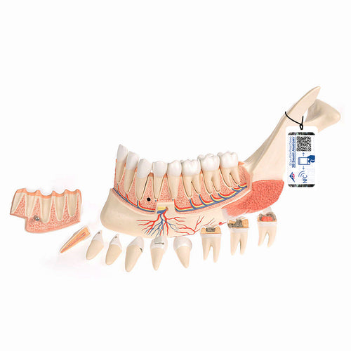 Model  falcă inferioară (jumătatea stângă) cu dinţi, nervi, vase şi glande bolnave, 19 părţi - 3B Smart Anatomy