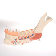Load image into Gallery viewer, Model  falcă inferioară (jumătatea stângă) cu dinţi, nervi, vase şi glande bolnave, 19 părţi - 3B Smart Anatomy