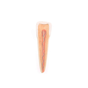 Model  falcă inferioară (jumătatea stângă) cu dinţi, nervi, vase şi glande bolnave, 19 părţi - 3B Smart Anatomy