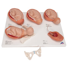 Load image into Gallery viewer, Model Stadii Travaliului, Mic - 3B Smart Anatomy