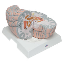 Load image into Gallery viewer, Model uriaş al creierului uman ,14 părţi - 3B Smart Anatomy