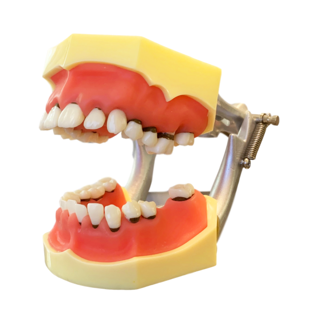 Model boală parodontală cu dinţi detaşabili cu şurub - 4024