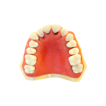 Load image into Gallery viewer, Model boală parodontală cu dinţi detaşabili cu şurub - 4024