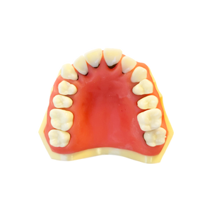 Model boală parodontală cu dinţi detaşabili cu şurub - 4024