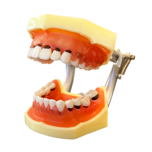 Model boală parodontală cu dinţi detaşabili cu şurub - 4023