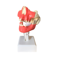 Load image into Gallery viewer, Kit complet manechin chirurgical avansat cu gingie moale şi suport + mandibulă edentată