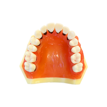 Load image into Gallery viewer, Model boală parodontală cu dinţi detaşabili cu şurub - 4023