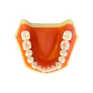 Model boală parodontală cu dinţi detaşabili cu şurub - 4023