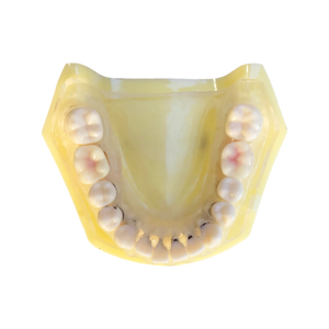 Model boală parodontală cu dinţi detaşabili cu şurub - 4028