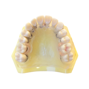 Model boală parodontală cu dinţi detaşabili cu şurub - 4028