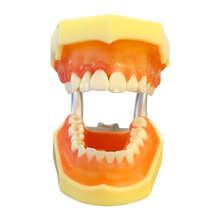 Load image into Gallery viewer, Model boală parodontală cu dinţi detaşabili cu şurub - 4022