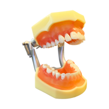 Load image into Gallery viewer, Model boală parodontală cu dinţi detaşabili cu şurub - 4022